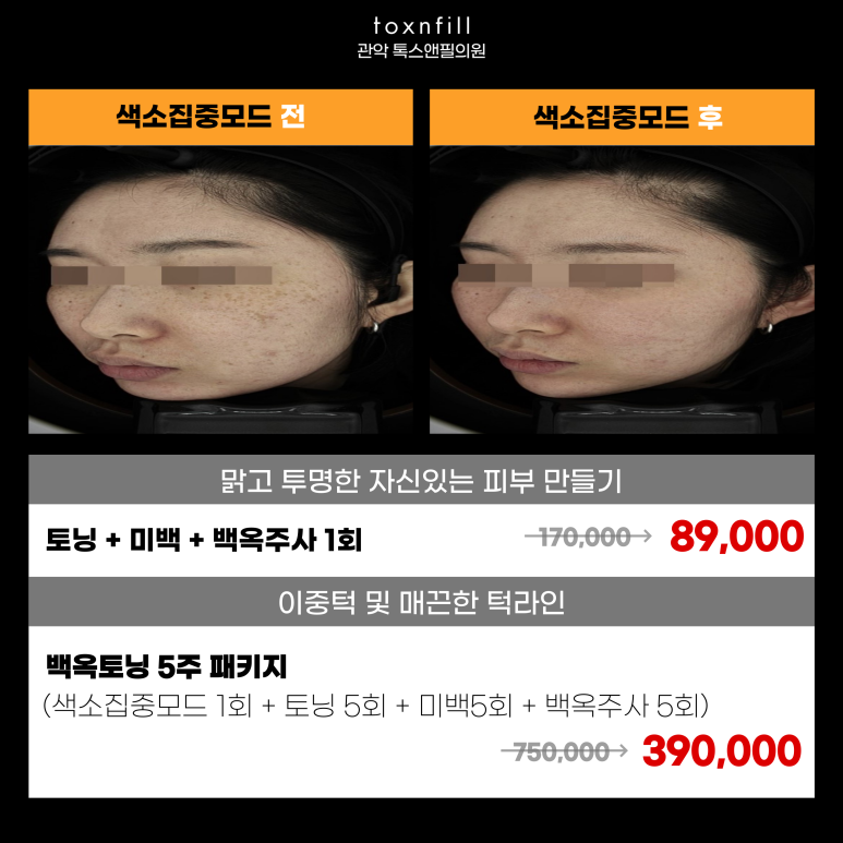 서울대입구역 피부과에서 제공하는 [12월 마지막 고객감사 이벤트] 관련 이미지 5