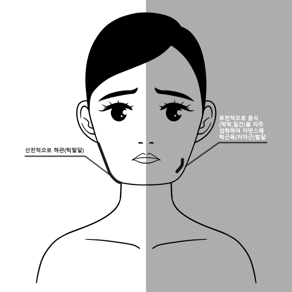 서울대입구역 피부과 사각턱보톡스 부드러운 V라인으로 관련 이미지 2