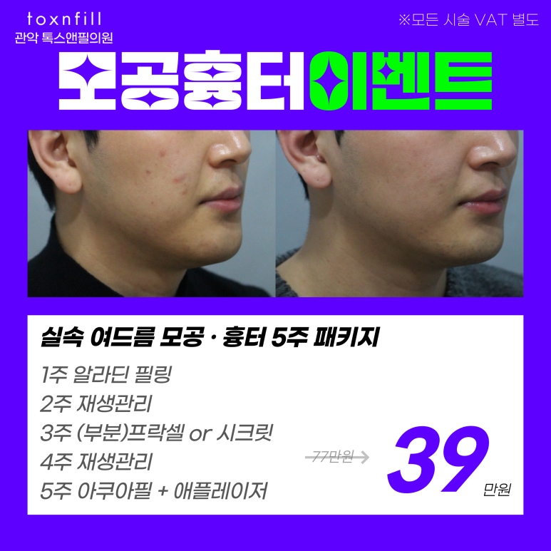 서울대입구역 피부과 ~28일까지 종합선물 이벤트 관련 이미지 3