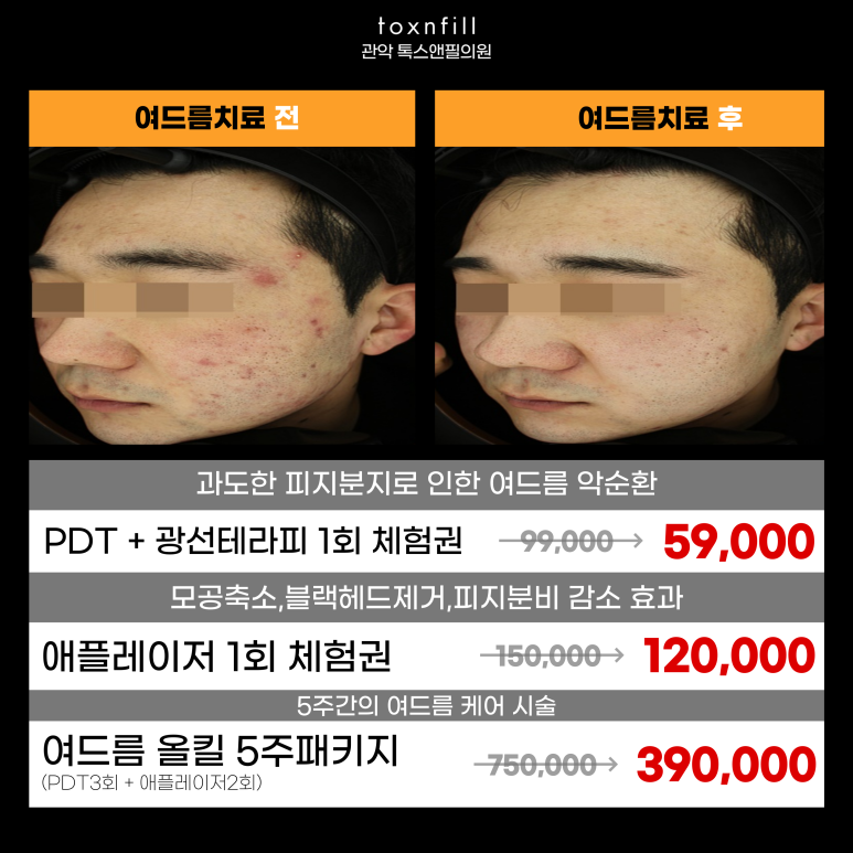 서울대입구역 피부과 여드름치료는 이곳으로 추천! 관련 이미지 6