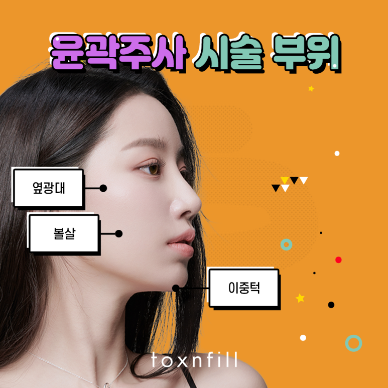 톡스앤필 날렵한 V라인 윤곽주사 관련 이미지 3