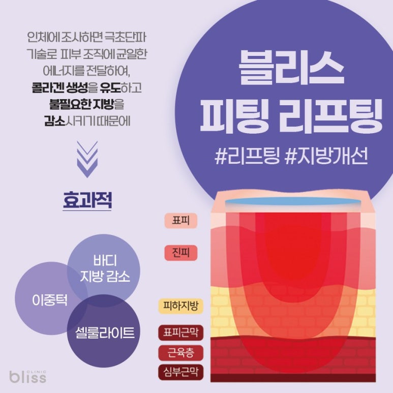 피팅 리프팅, 어떤 시술일까? 관련 이미지 2