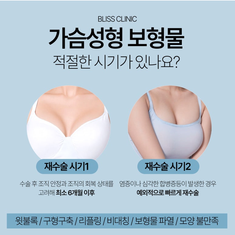 가슴확대수술 보형물 교체 시기 10년마다? 보형물 종류 방법 추천 관련 이미지 3