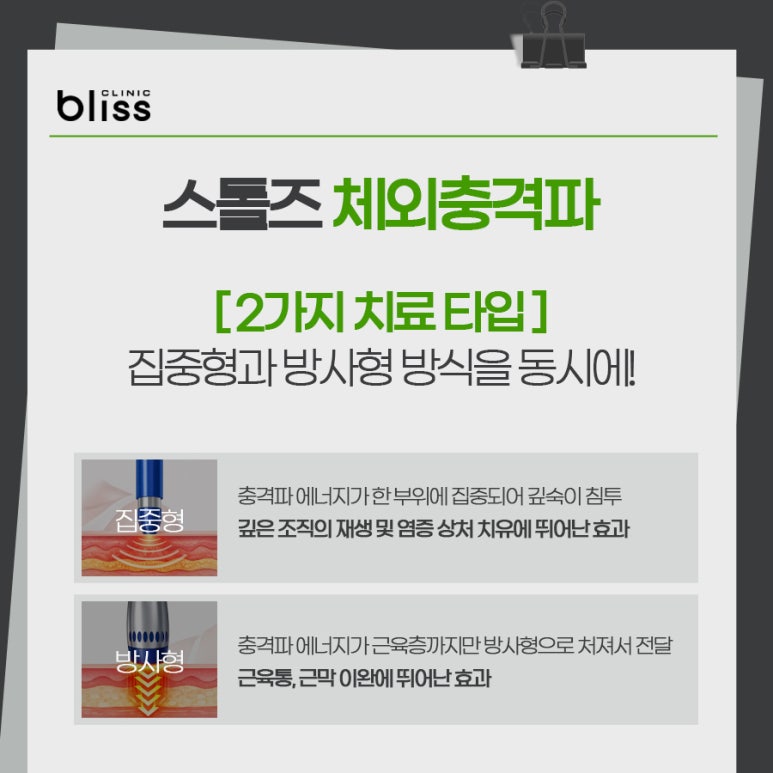 집중형과 방사형 스톨즈 체외충격파 보유한 블리스의원 관련 이미지 4