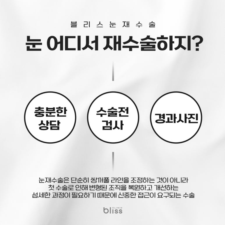 눈재수술, 시기부터 회복까지 제대로 준비하는 법 관련 이미지 4