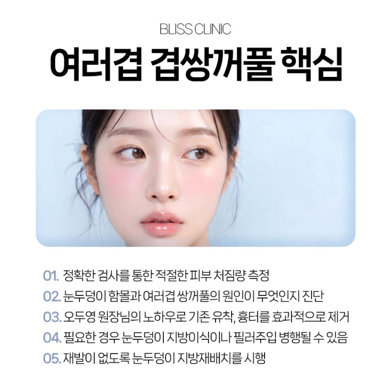 5월 황금연휴, 두세겹으로 보이는 겹쌍꺼풀 교정 블리스에서 관련 이미지 5