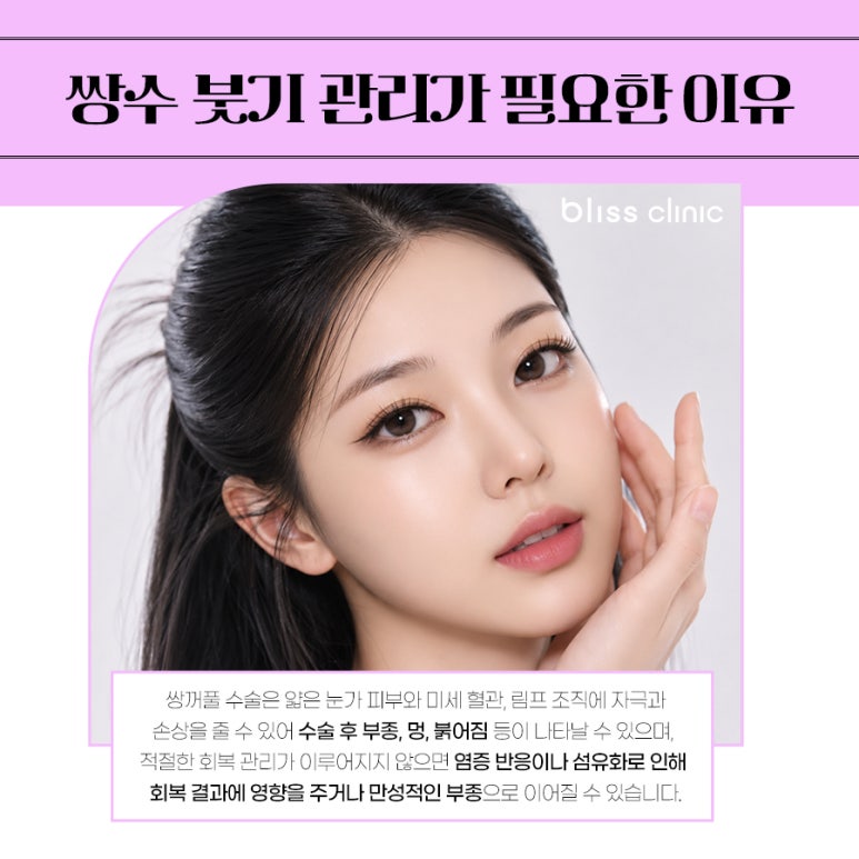쌍수 붓기 기간, 회복 과정 및 빨리 빼는 법 노하우 관련 이미지 2