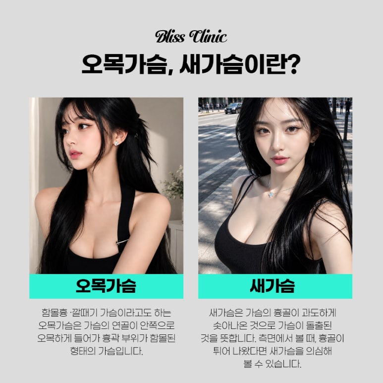 오목가슴 새가슴 성공적인 가슴 성형을 위한 맞춤 솔루션 관련 이미지 2