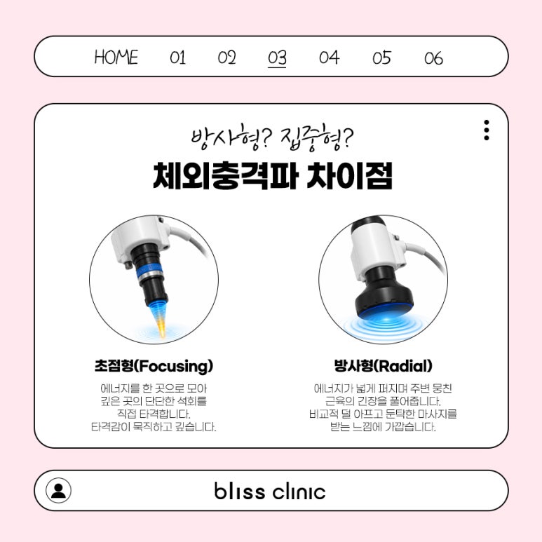 목어깨 담걸림, 스톨즈 체외충격파 효과 있을까? 관련 이미지 4