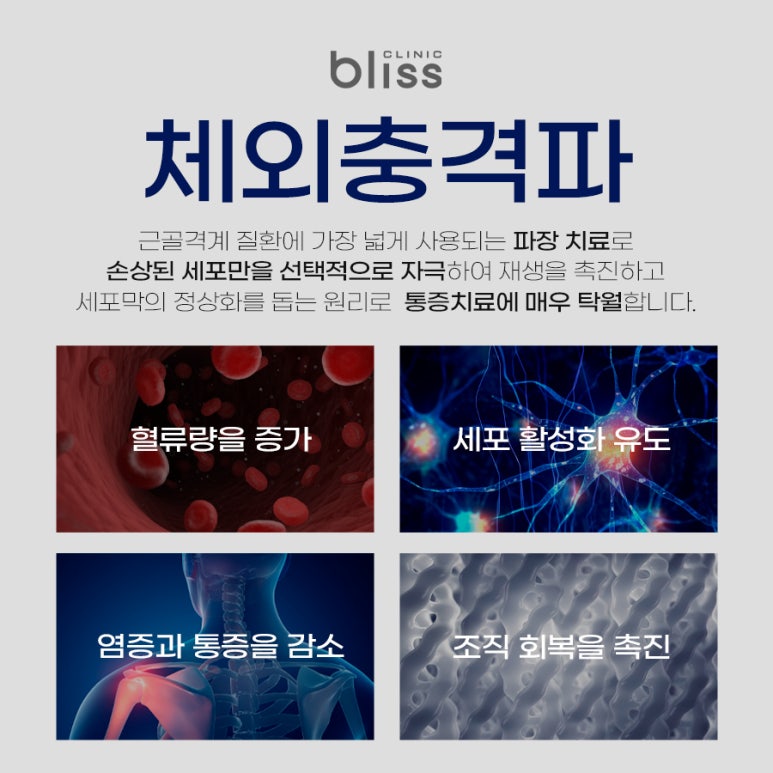 비수술 통증치료, 체외충격파 어떤 치료일까? 관련 이미지 2