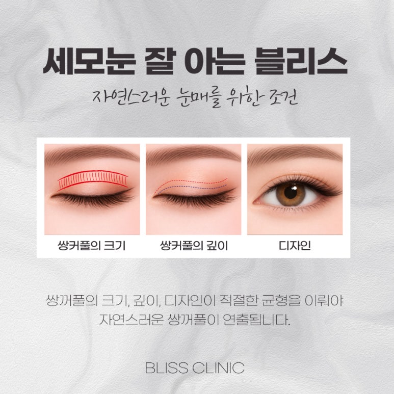 사나운 눈매로 보이는 세모눈 원인과 교정 방법 관련 이미지 5