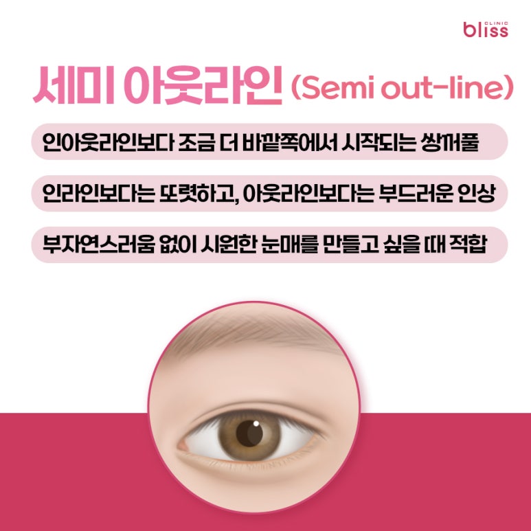 대표적인 쌍꺼풀 라인 5가지, 내 눈에 맞는 스타일은? 관련 이미지 5