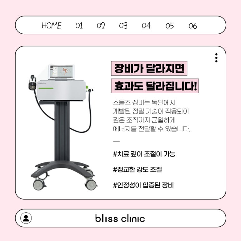 목어깨 담걸림, 스톨즈 체외충격파 효과 있을까? 관련 이미지 5