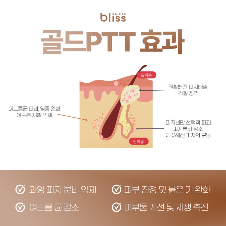 블리스 골드 PTT 여드름 케어로 근본적 원인 해결하세요. 관련 이미지 4