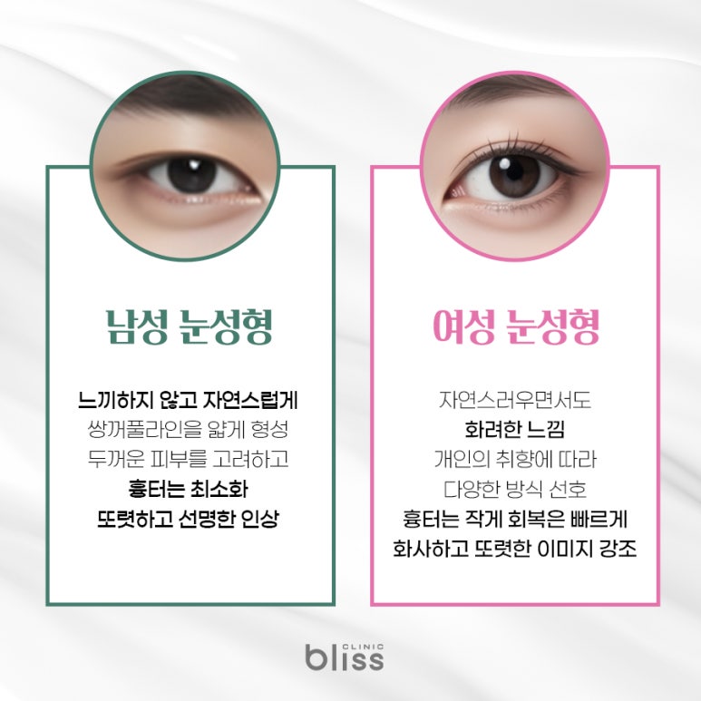 남자 눈성형, 긍정적인 인상으로 변화는 핵심 포인트 관련 이미지 2