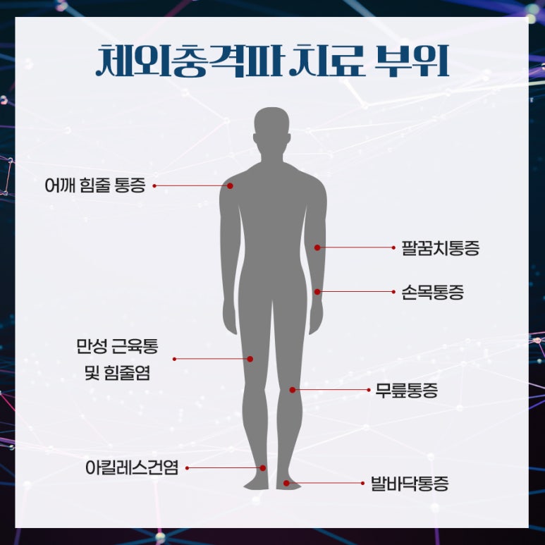 비수술 통증치료, 체외충격파 어떤 치료일까? 관련 이미지 5
