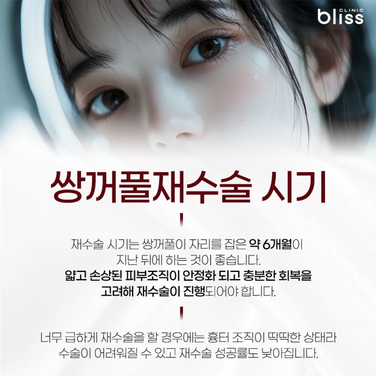 쌍꺼풀 재수술 방법 이전 수술의 실패 원인 파악이 우선 관련 이미지 4