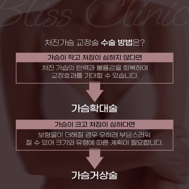 처진가슴수술 고민된다면 관련 이미지 4