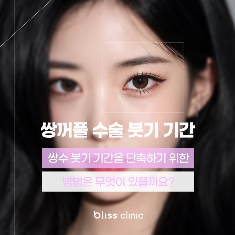 쌍수 붓기 기간, 회복 과정 및 빨리 빼는 법 노하우 관련 이미지 1