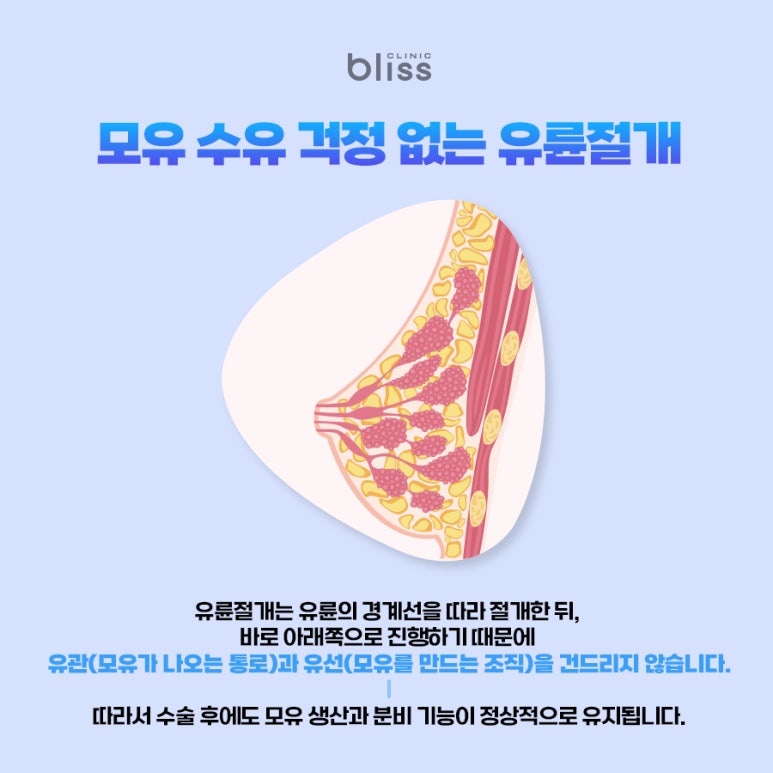 유륜절개 가슴성형 Q&A, 꼭 알아두세요 관련 이미지 3