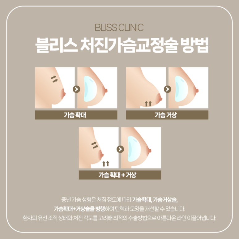 출산과 완모 후, 중년 가슴성형 어떤 기준으로 선택해야 할까 관련 이미지 3