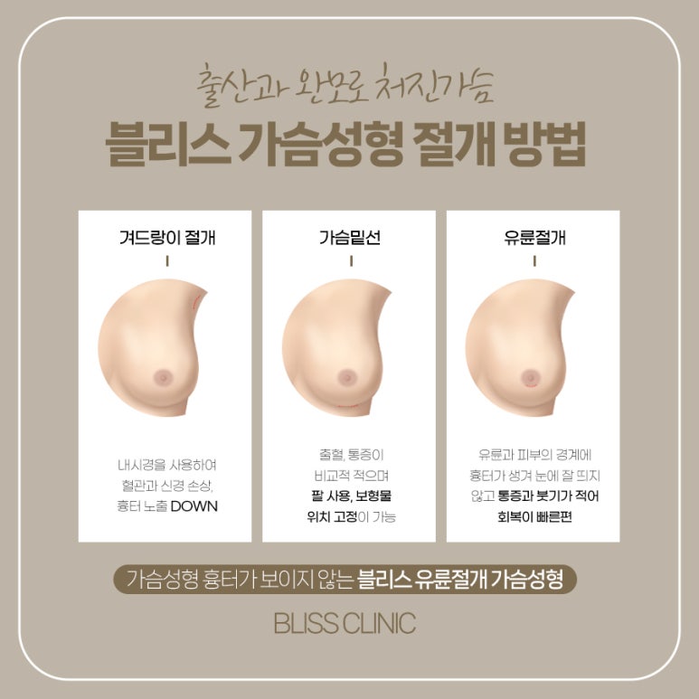 출산과 완모 후, 중년 가슴성형 어떤 기준으로 선택해야 할까 관련 이미지 7