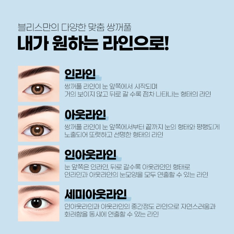 첫눈성형 자연스러운 매몰법 성공하기 위한 체크리스트 관련 이미지 4
