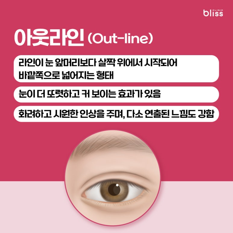 대표적인 쌍꺼풀 라인 5가지, 내 눈에 맞는 스타일은? 관련 이미지 3