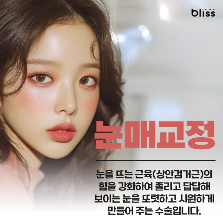 졸려 보이는 눈? 시원하고 또렷한 눈매 만드는 눈매교정 가이드 관련 이미지 2