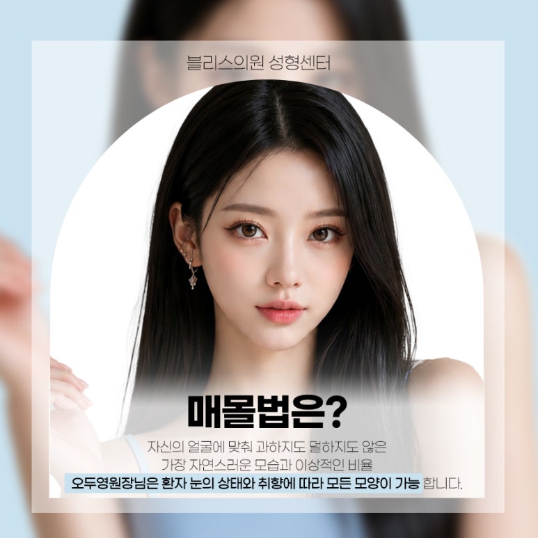 첫눈성형 자연스러운 매몰법 성공하기 위한 체크리스트 관련 이미지 2