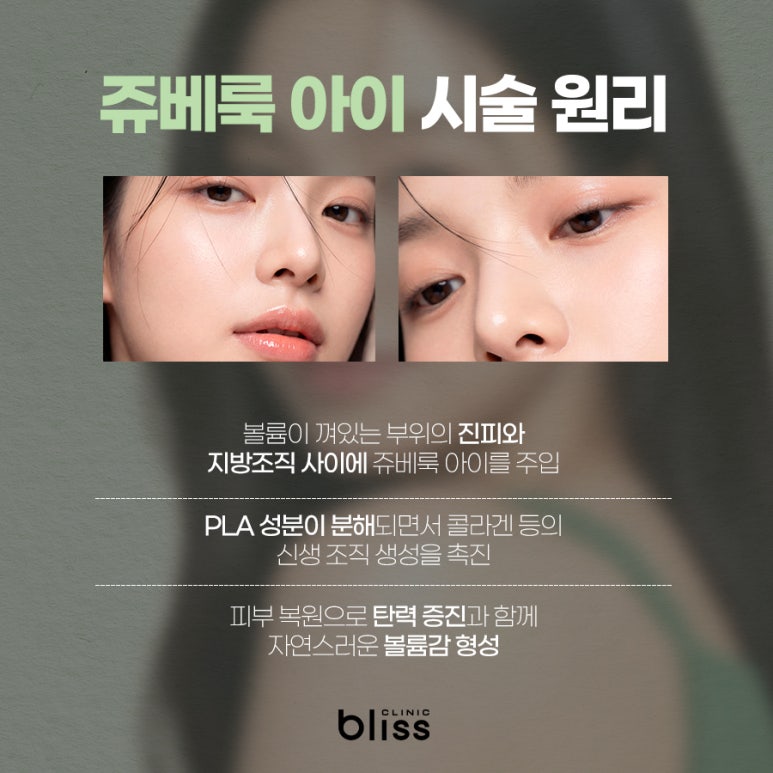 쥬베룩아이 효과 및 부작용 결절 총정리 관련 이미지 6