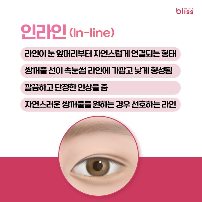 대표적인 쌍꺼풀 라인 5가지, 내 눈에 맞는 스타일은? 관련 이미지 2