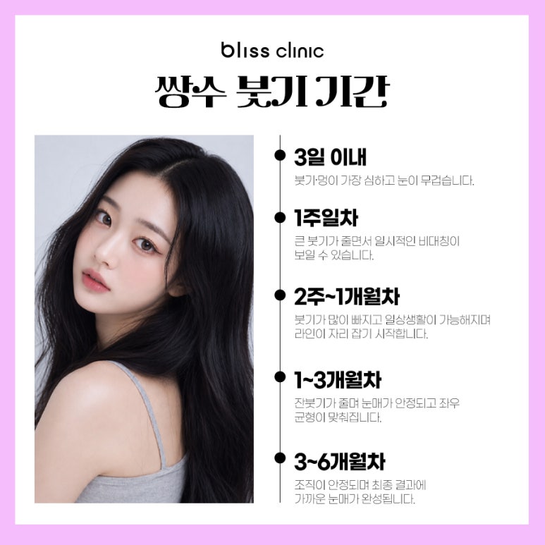 쌍수 붓기 기간, 회복 과정 및 빨리 빼는 법 노하우 관련 이미지 3