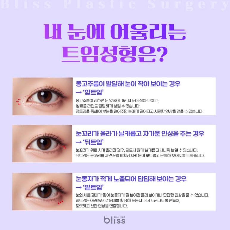 트임 성형, 내 눈에 맞는 선택 법과 수술 후 관리까지 관련 이미지 3
