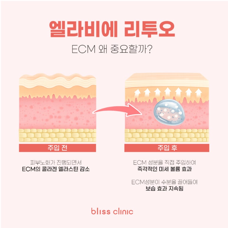 리투오 스킨부스터 효과 주기, 통증까지 관련 이미지 4