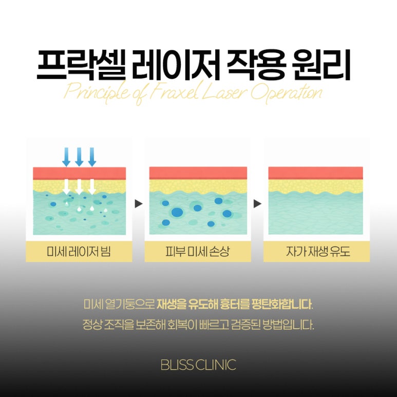 프락셀 효과 시술 후 관리방법 관련 이미지 3
