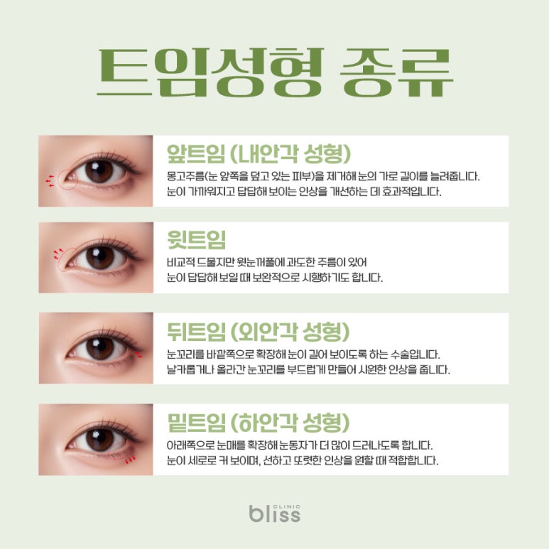 트임 성형, 어떤 경우에 필요할까? 장점과 한계 총정리 관련 이미지 2