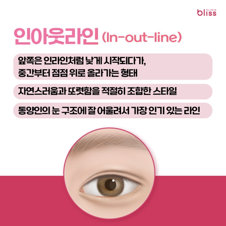대표적인 쌍꺼풀 라인 5가지, 내 눈에 맞는 스타일은? 관련 이미지 4