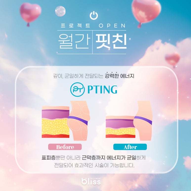 블리스의원 월간핏친 프로젝트 바디라인관리 4월 이벤트 관련 이미지 3