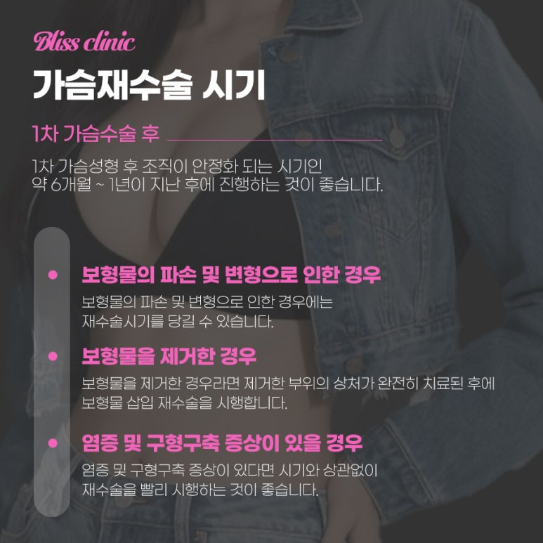 가슴재수술 보형물 교체 시기는 어떻게 결정될까? 관련 이미지 3