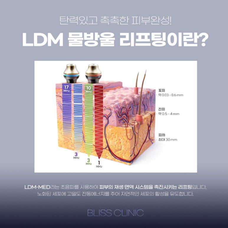 LDM 물방울 리프팅 효과 언제부터? 통증 유지기간 관련 이미지 2
