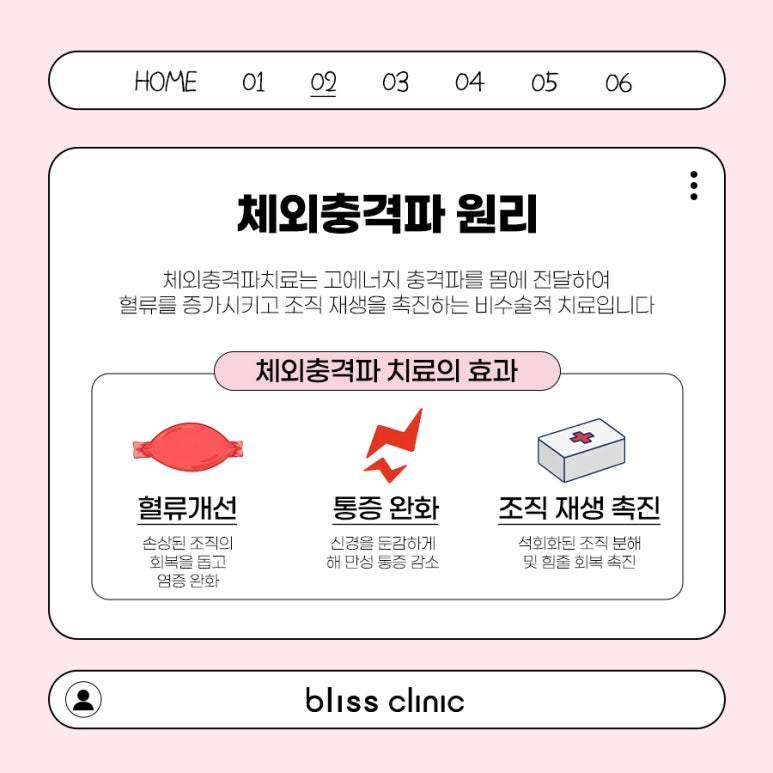 목어깨 담걸림, 스톨즈 체외충격파 효과 있을까? 관련 이미지 3