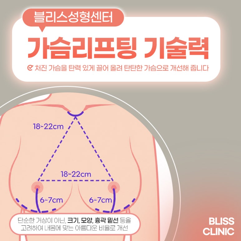 Breast Lift for Sagging Breasts: The Method Should Vary Depending on Body Shape and Degree of Sagging image 2