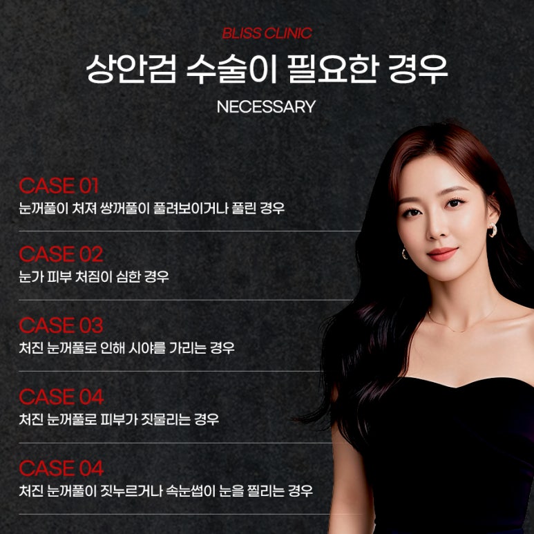 처진 눈꺼풀 올리기 상안검수술 후기 관련 이미지 3