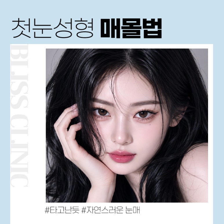 첫눈성형 자연스러운 매몰법 성공하기 위한 체크리스트 관련 이미지 1