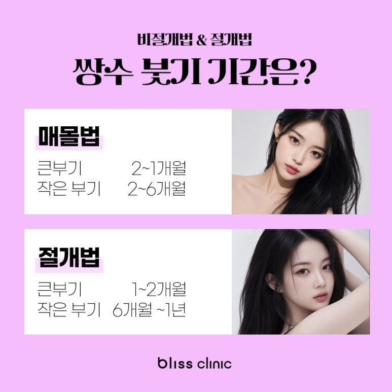 쌍수 붓기 기간, 회복 과정 및 빨리 빼는 법 노하우 관련 이미지 4