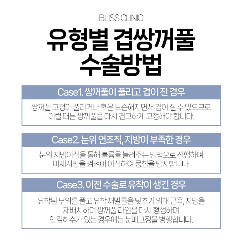 5월 황금연휴, 두세겹으로 보이는 겹쌍꺼풀 교정 블리스에서 관련 이미지 4