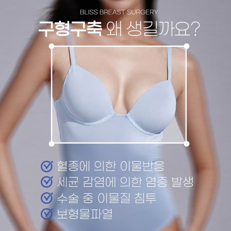 가슴 구형구축 재수술 받게 될 확률 관련 이미지 3