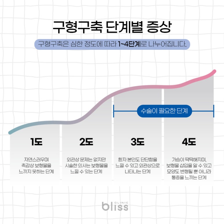 가슴 구형구축 재수술 받게 될 확률 관련 이미지 4