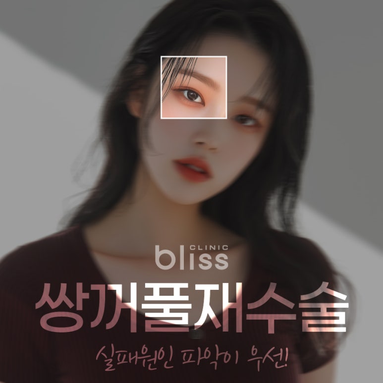 쌍꺼풀 재수술 방법 이전 수술의 실패 원인 파악이 우선 관련 이미지 1